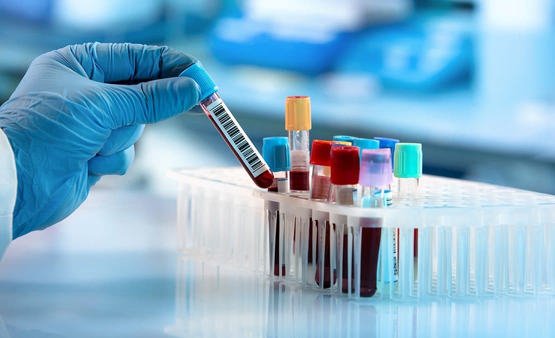 Department of Hematology